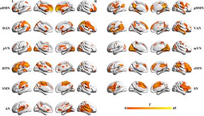 The Relationship Between Vitamin D, Clinical Manifestations, and Functional Network Connectivity in Female Patients With Major Depressive Disorder